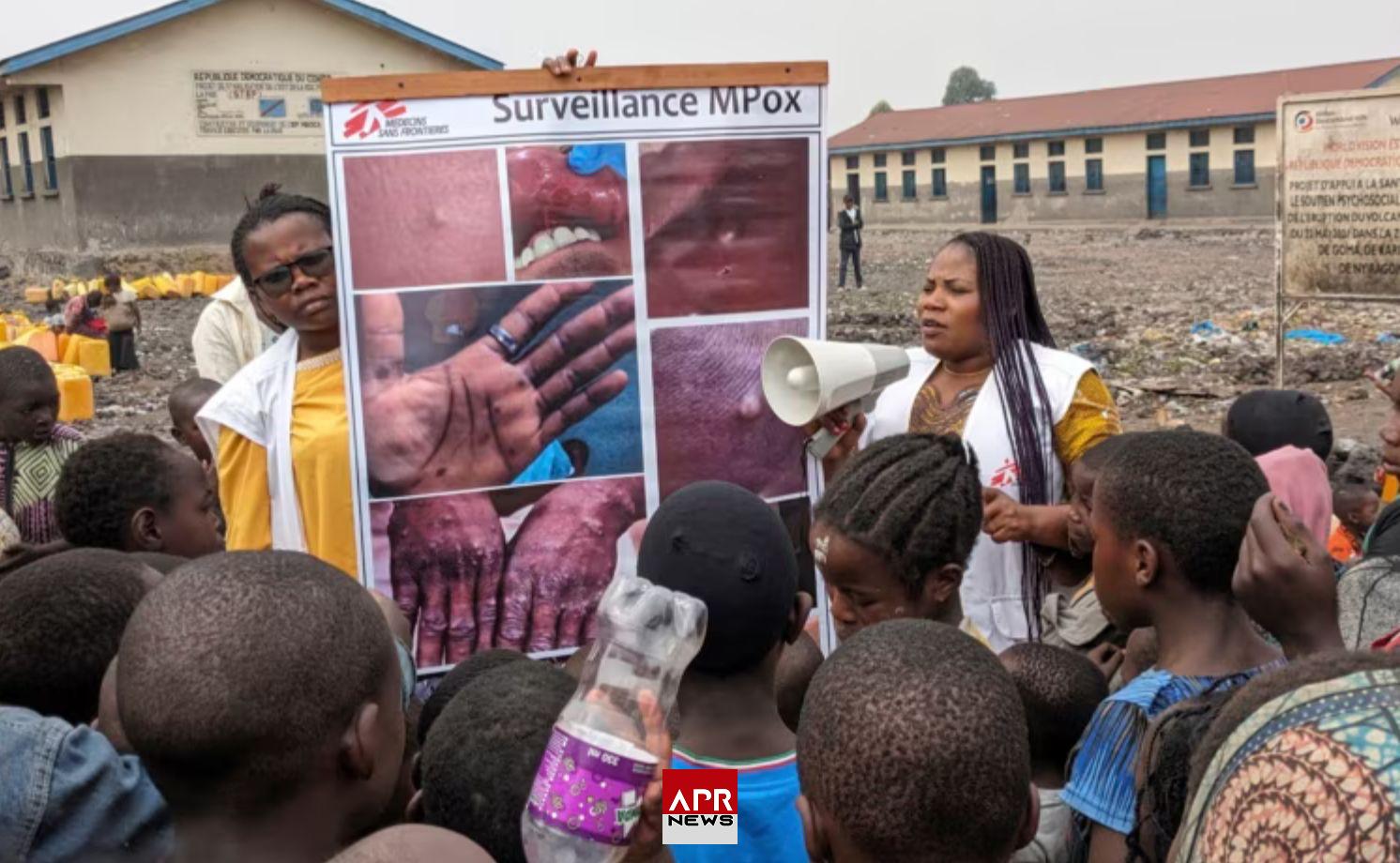 APRNEWS: Le mpox « n’est pas le nouveau Covid », selon l’OMS