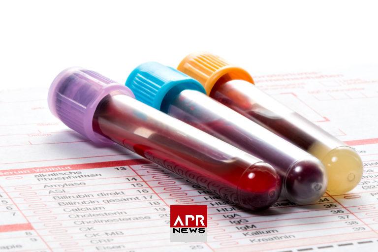 APRNEWS: Prise de sang APRNEWS: Prise de sang