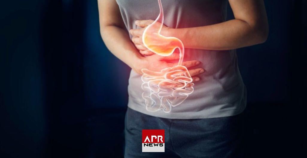 APRNEWS: Brûlure d’estomac APRNEWS: Brûlure d’estomac