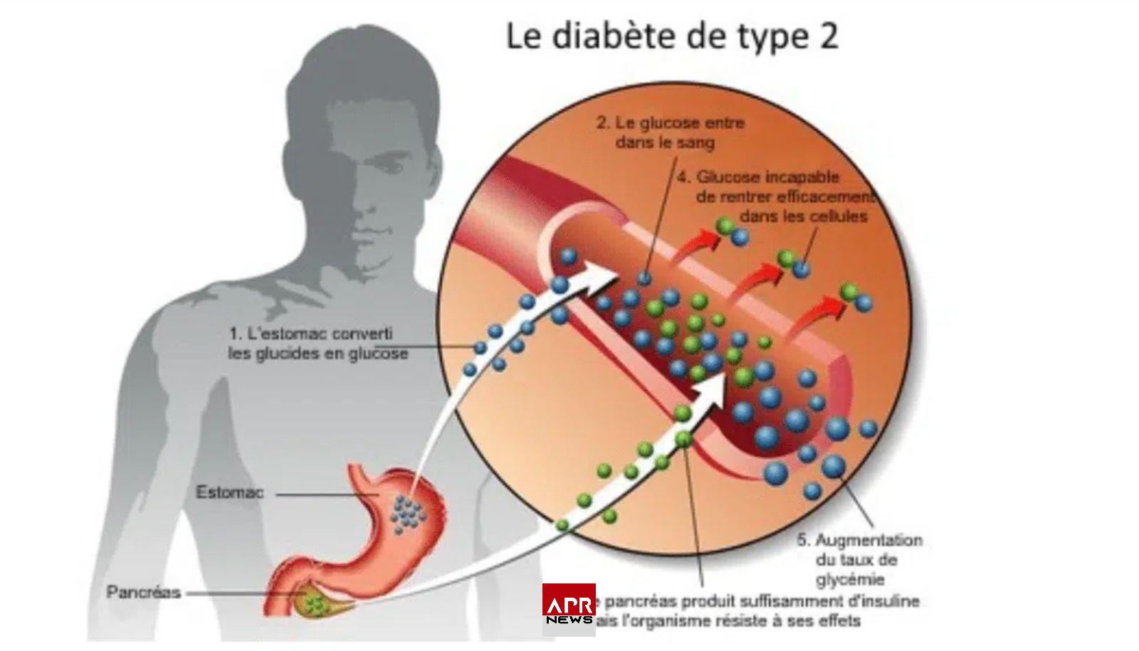 APRNEWS: Diabète de type 2 APRNEWS: Diabète de type 2